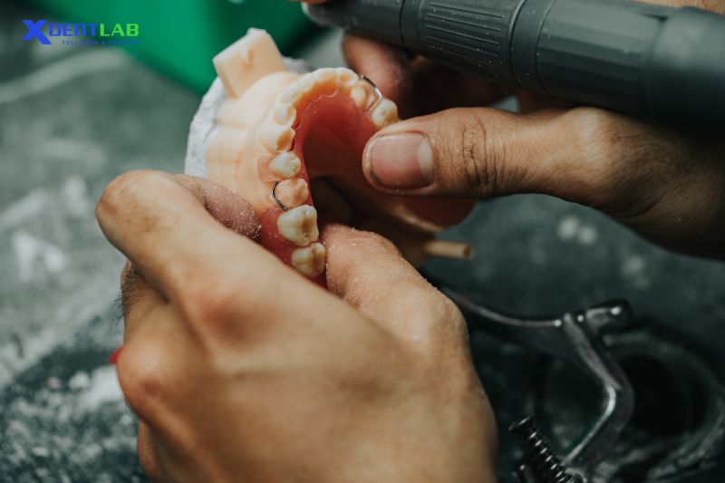 full-removable-denture full-removable-denture